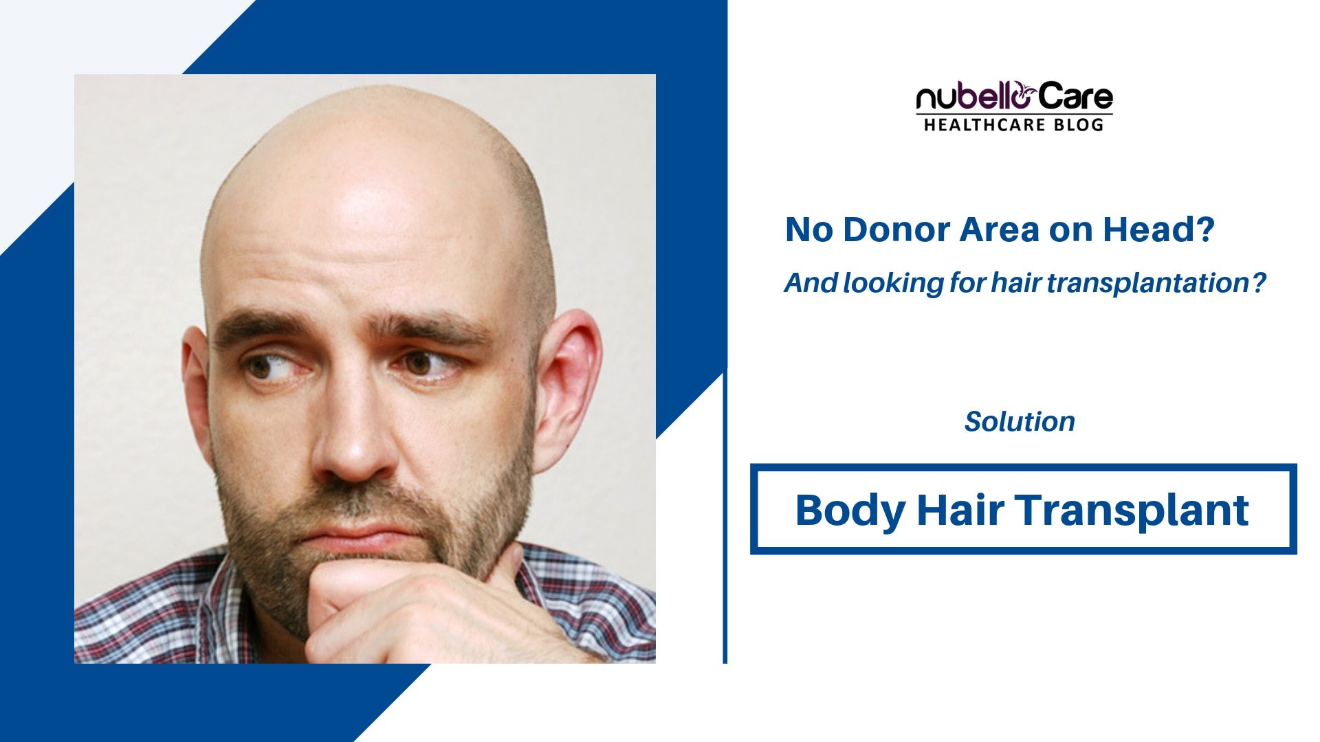 Best body hair transplant in Mumbai